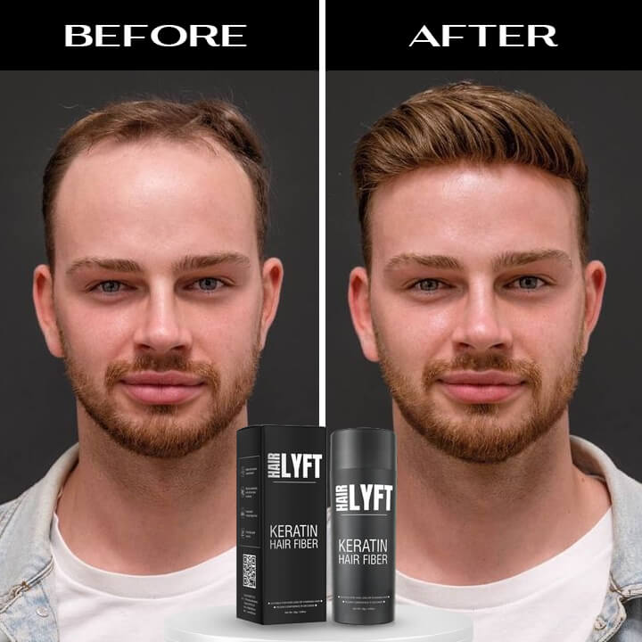 What Are the Best Hair Fibers? Discover Why HairLyft Leads the Way?