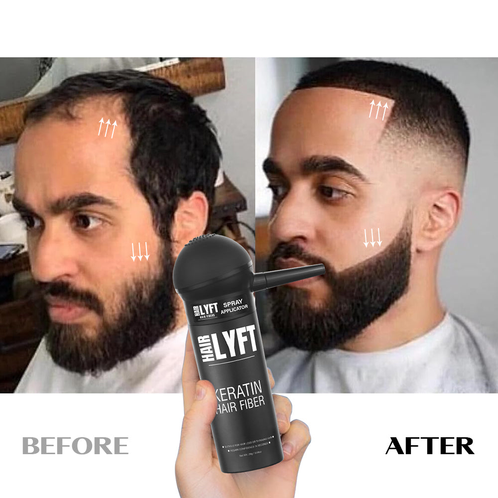 Hair_Fiber_Spray_applicator_before_and_after_image male by Hairyft