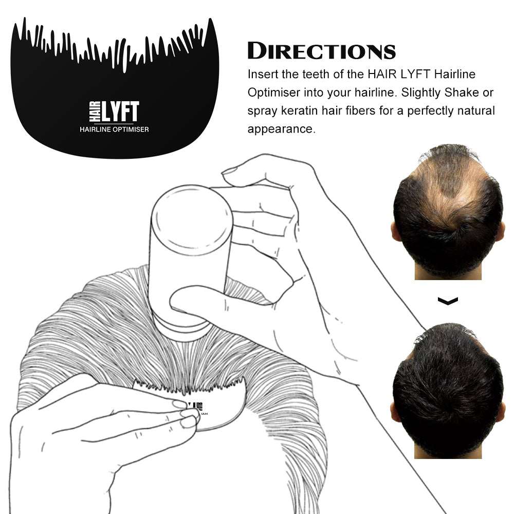 Hairline optimiser how to use by Hairlyft