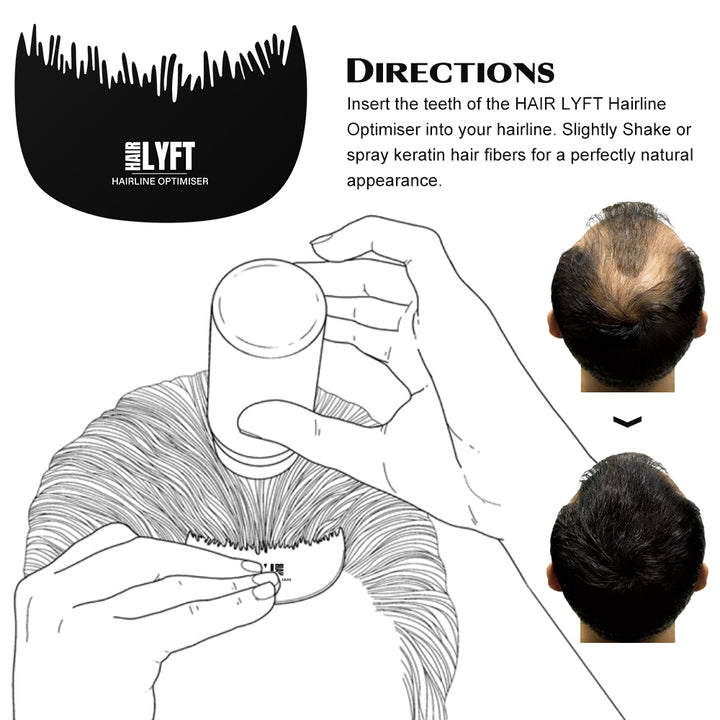 Hairline optimiser how to use by Hairlyft